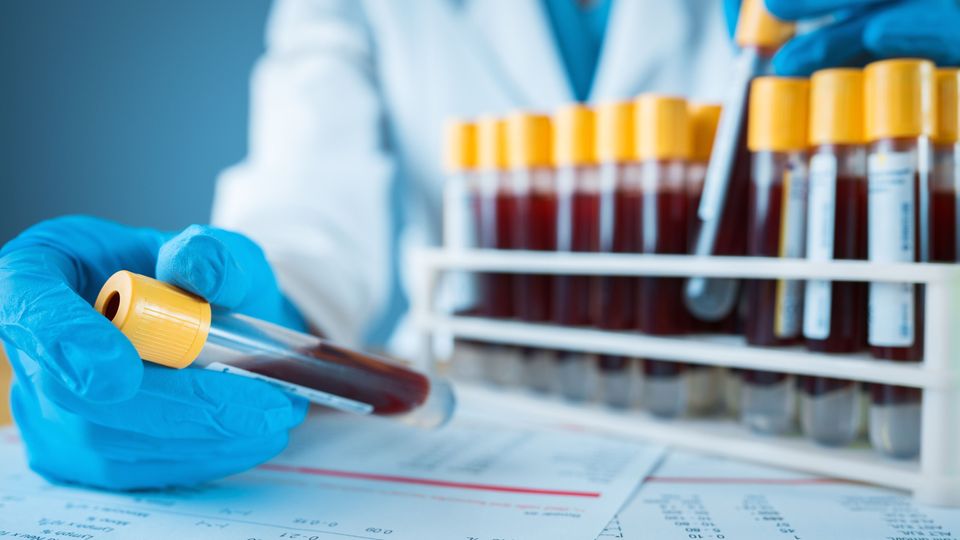 Blood samples in test tubes.