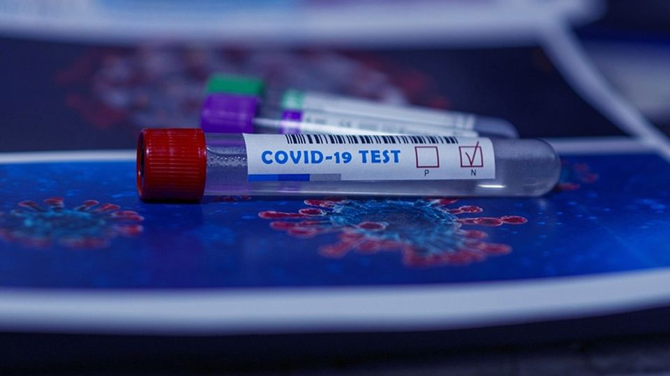 COVID-19 test vacutainer with sample inside