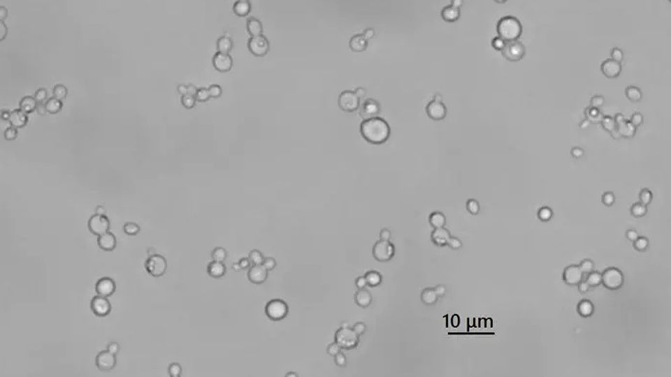 Yeast under a microscope.