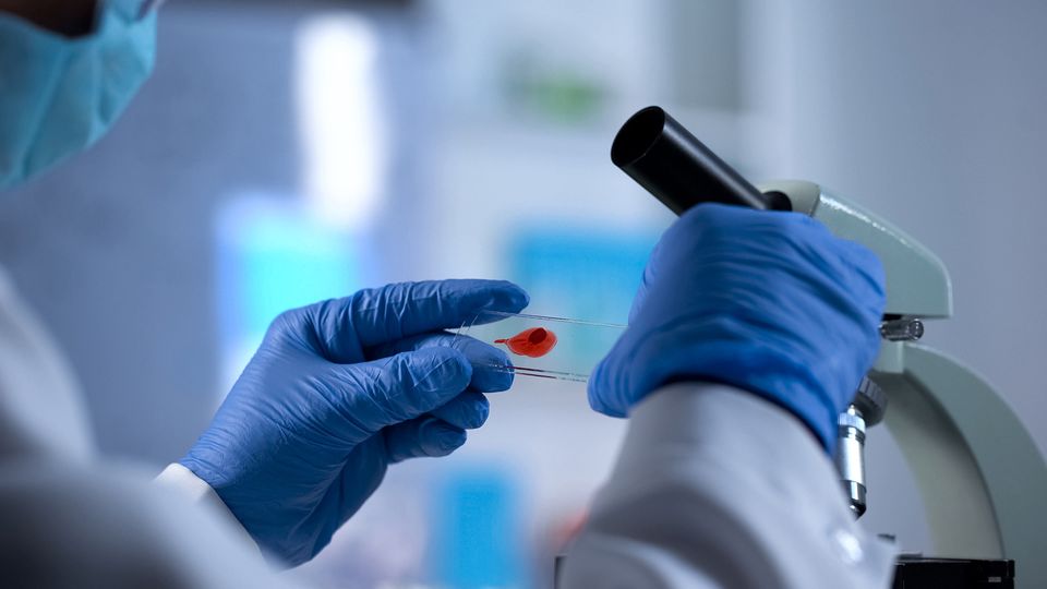 Scientist examining a blood sample on a microscope slide, focusing on blood analysis and research.