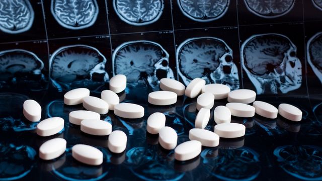 White pills on top of a brain scan.