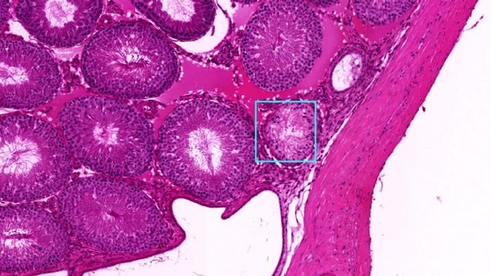 Testis tissues under a microscope.