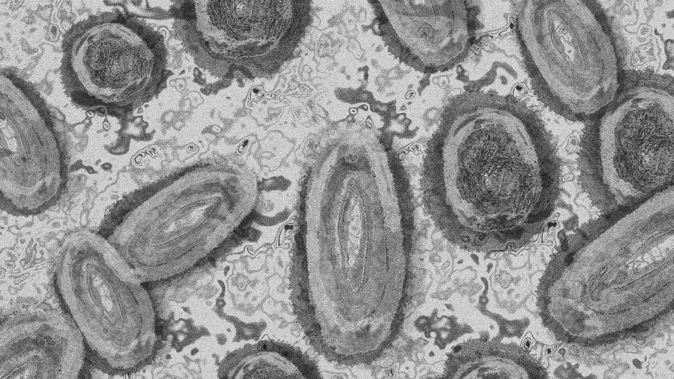 Monkey pox under a microscope.