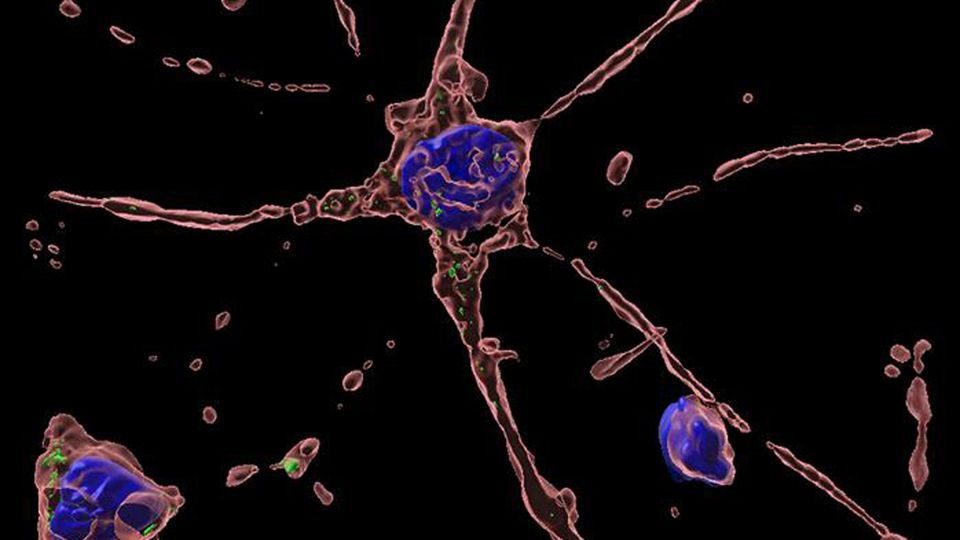 Primary neurons from human kidney cells infected with Hepatitis E and excreted in the urine.