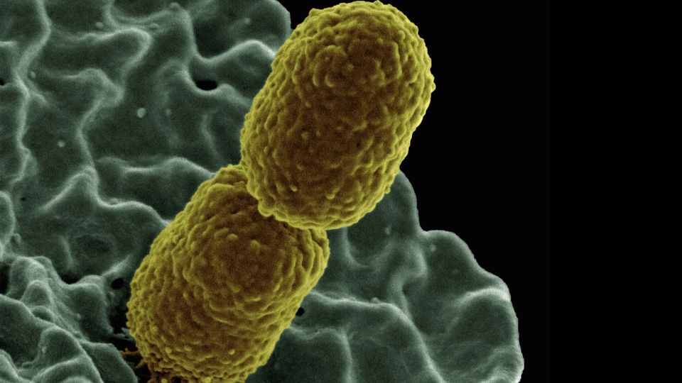 A Klebsiella pneumoniae bacteria interacting with a human neutrophil.