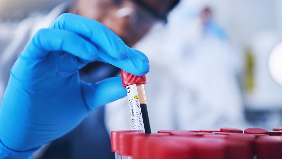 Gloved hand holding a blood sample vial in a laboratory, highlighting biomarker research.