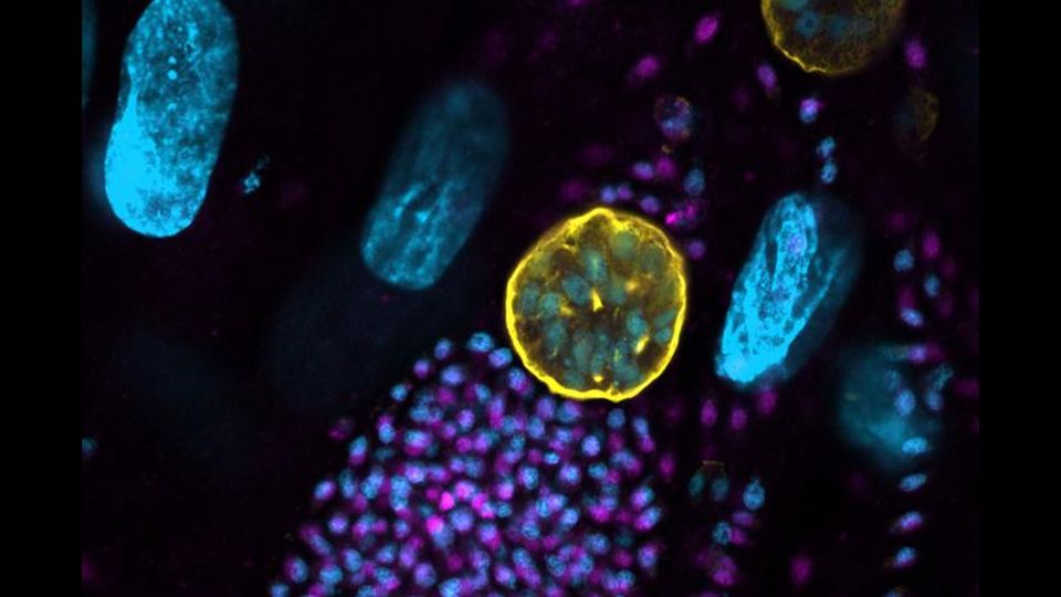 A microscope image of toxoplasma gondii, shown in pink, blue and yellow.