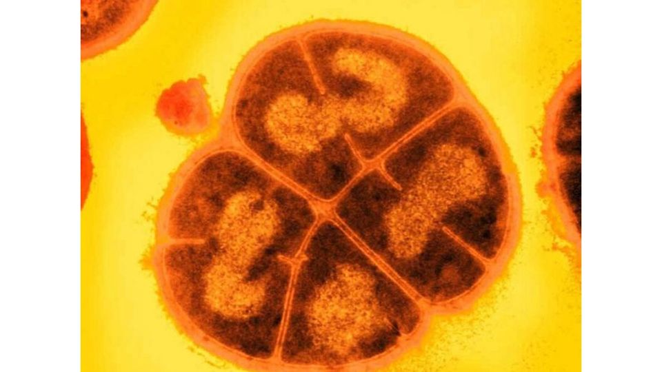 A microscope image of a cluster of bacteria.