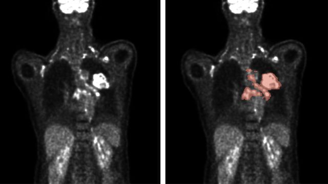 AI Algorithms Improve Medical Image Analysis | Technology Networks