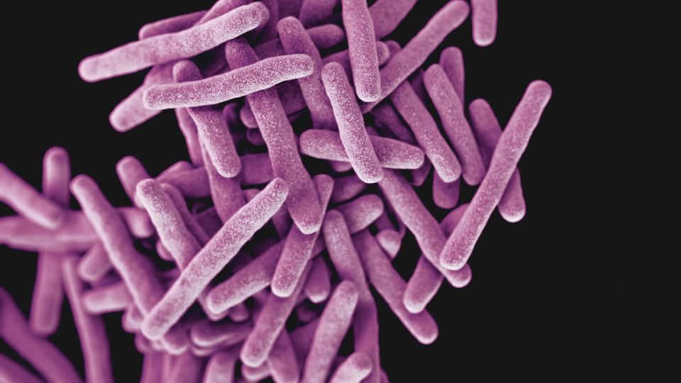 Drug-resistant, Mycobacterium tuberculosis bacteria, the pathogen responsible for causing the disease tuberculosis (TB).
