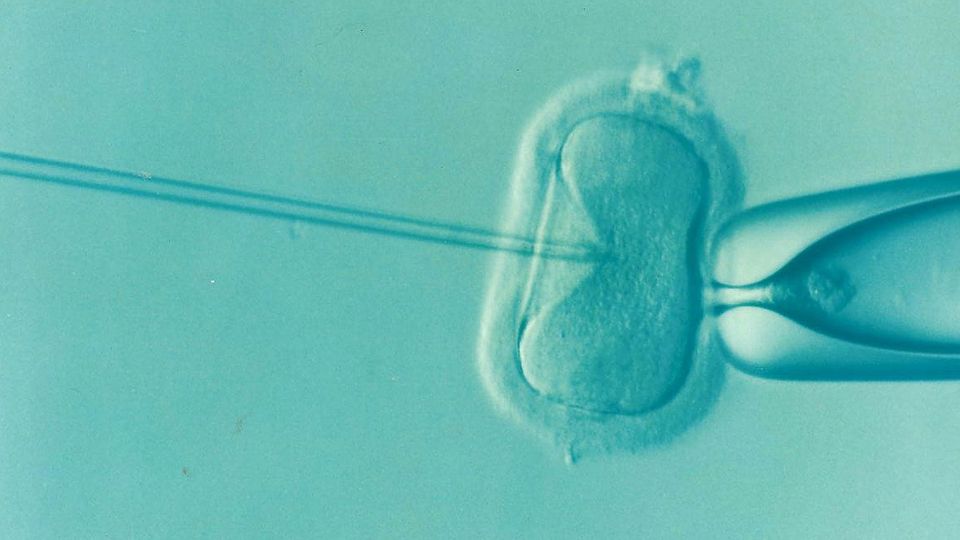 Invitro fertilization technique