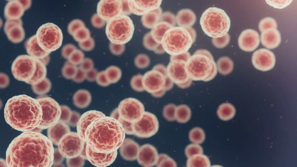 Cancer cells.