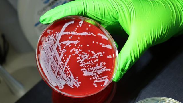 黄色ブドウ球菌がどのように適応するかを遺伝子研究で明らかに