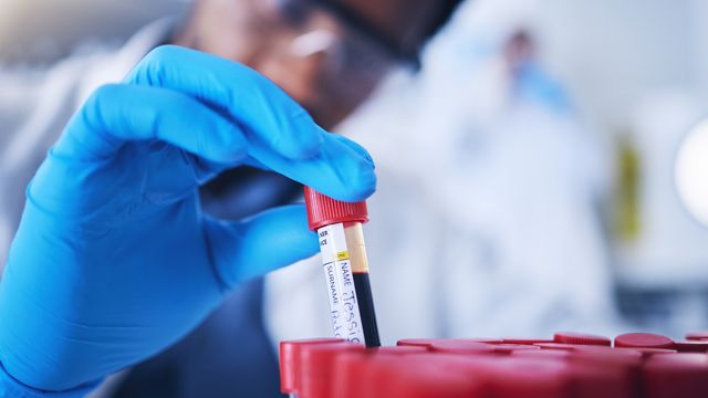 A scientist wearing blue gloves examining a labeled blood sample in a laboratory, representing blood biomarker research. 