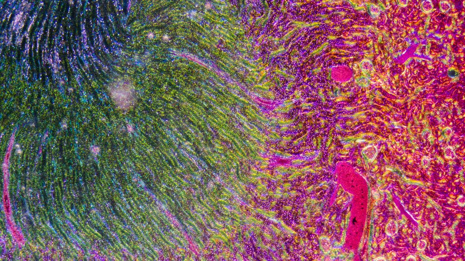 Microscopic image of kidney tissue.