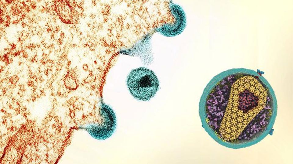HIV particles exit an infected immune cell, with an inset showing the details of a HIV virion.