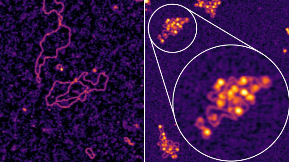 Atomic force microscopy images show hepatitis B DNA in its natural state and a zoomed-in look at how it wraps around human histones during an infection. 
