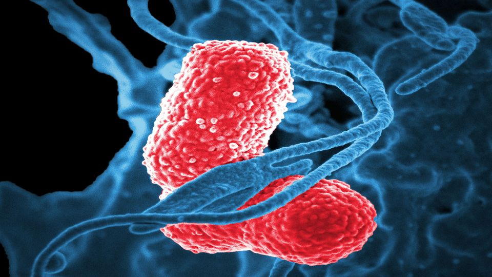 Klebsiella pneumoniae bacteria, which are known to cause severe hospital acquired, nosocomial infections.