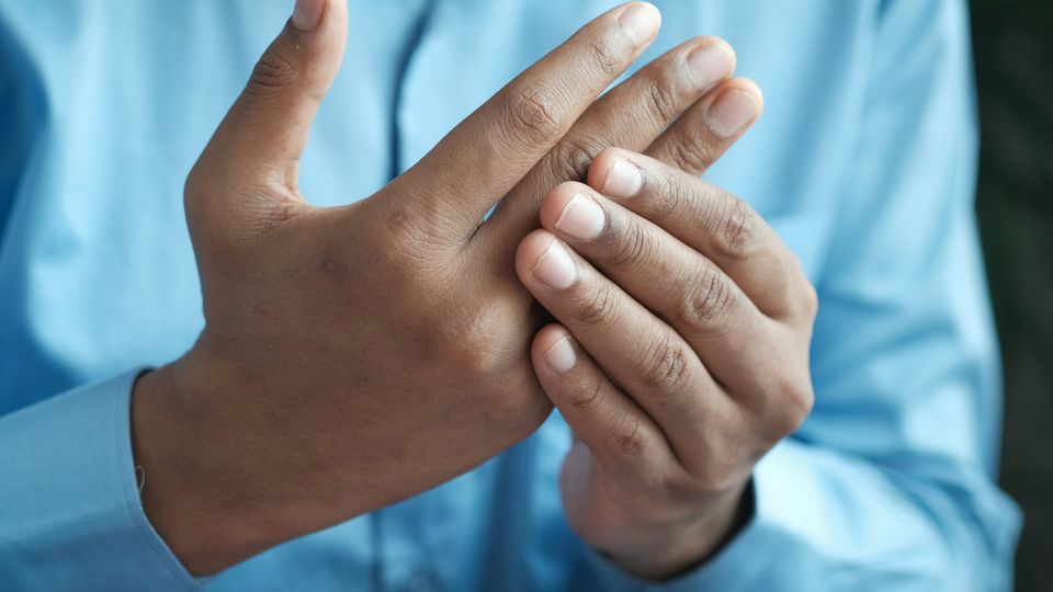 A man in a blue shirt with arthritis holding his hands