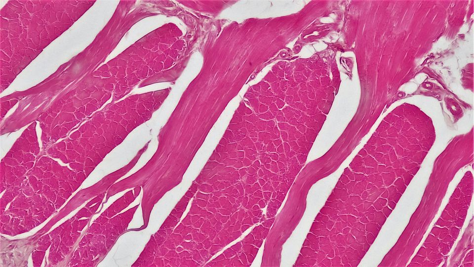 A cross section of whole skeletal muscle tissue.