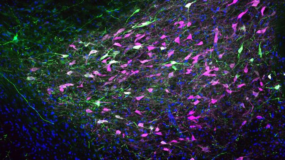 Brain cells (magenta) in the reward center of a rat’s brain release dopamine in response to opioids. 