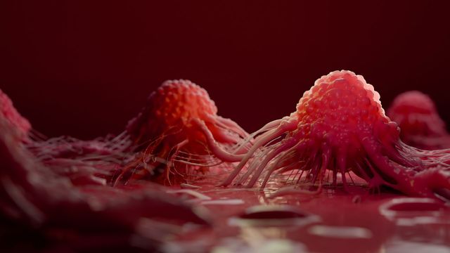 Cancer cells infiltrating the extracellular environment. 