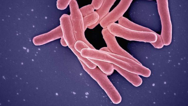 An electron microscope image of Mycobacterium tuberculosis particles, colored in pink. 