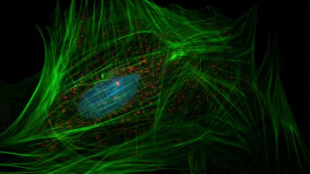 Fibroblasts: Diverse Populations, Specialized Roles