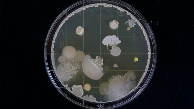 New Strategy Blocks Bacteria From Host Cell Binding | Technology Networks