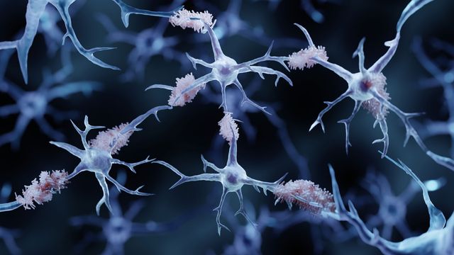 アルツハイマー病の研究は、刺し傷免疫分子を標的にします