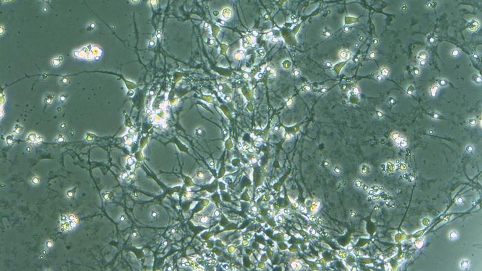 Cell models (pictured are neurons produced from human embryonic stem cells) allow studying how changes in the genes affect the shape and function of the cell.