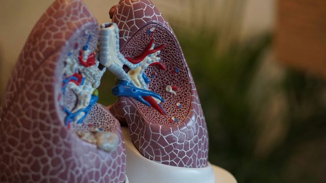 A model of the human lungs, an organ impacted by cystic fibrosis. 