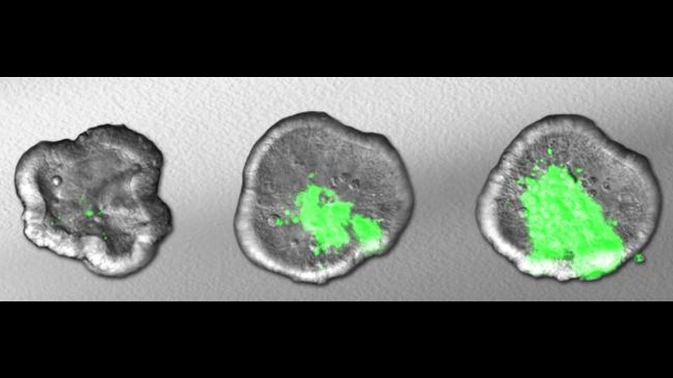 Three gut organoids, with a growing spread of green Shigella bacteria.
