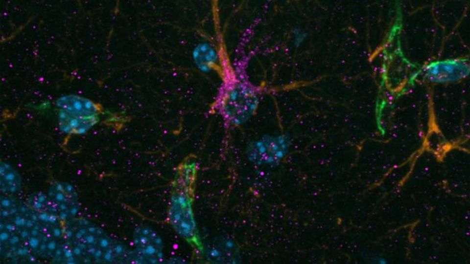 Fluorescence microscopy image showing astrocytes and other cells in the brain with distinct color markers.