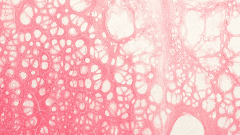A complex web of cells and blood vessels.