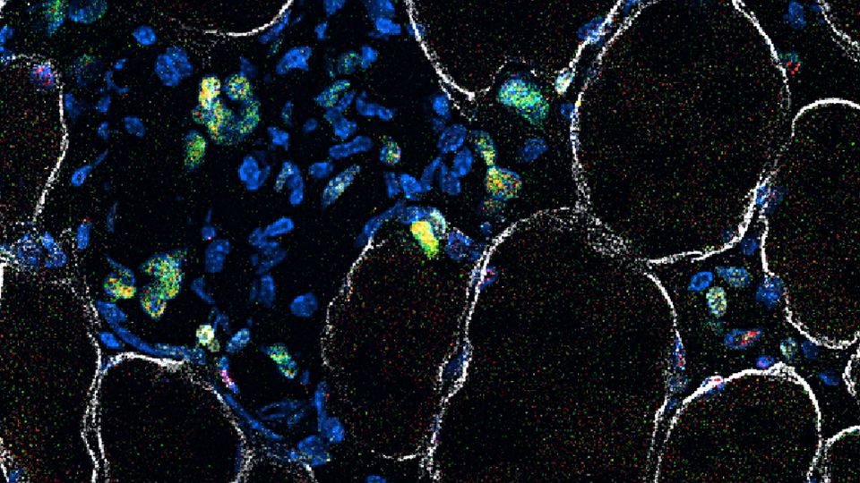 Microscopic florescent image of muscle stem cells at different stages making muscle.