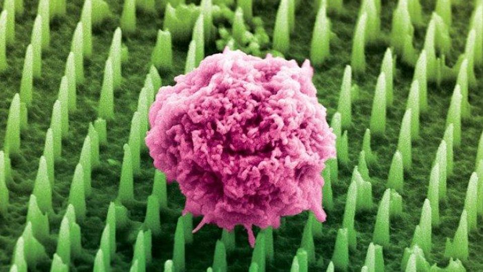 A colorized image of a biological sample (pink) on a nanoneedle patch (green).