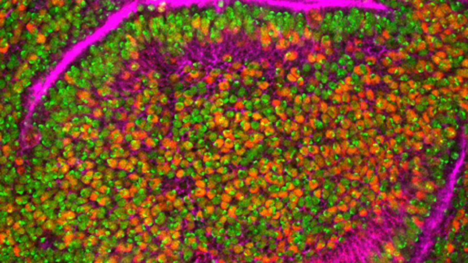 A cluster of cells, labelled in pink, orange and green, organizing themselves into sections.