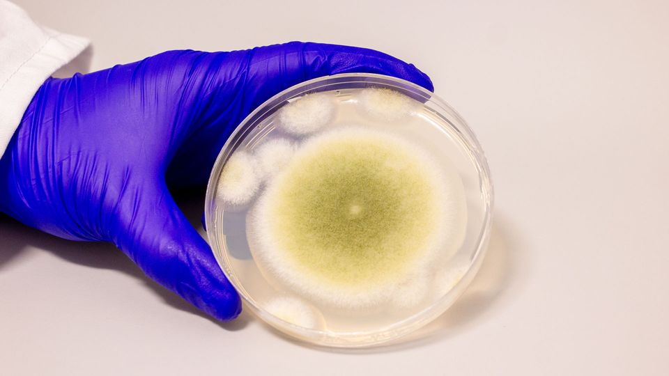 A sample of Aspergillus flavus cultured in the Gao Lab.