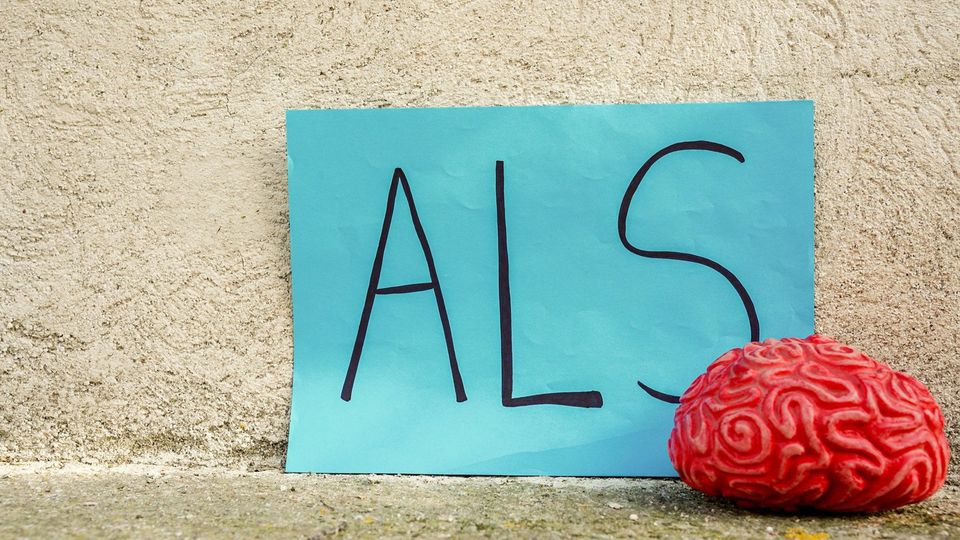 A blue sign with the letters ALS next to a model of a human brain.