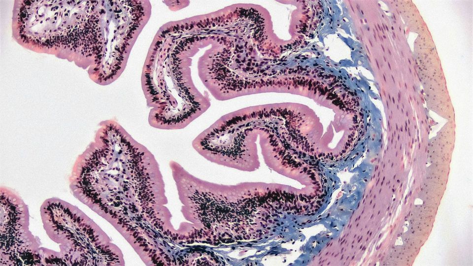 A cross-section of epithelial tissue under a microscope.