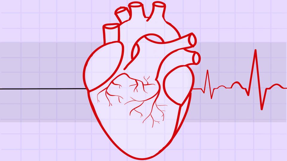 Drawing of a human heart on pink electrocardiogram paper with a electrocardiogram reading on the right of the heart.
