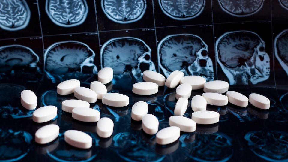 A group of white pill painkillers in front of a screen featuring multiple brain scan images.