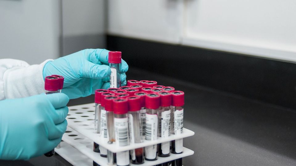 A person wearing gloves and a lab coat places blood test tube vials into a rack.