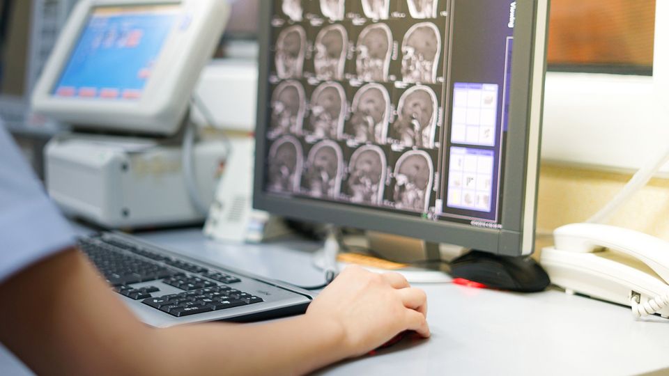 A doctor at a computer looking at images of the human brain.