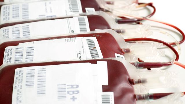 Multiple labeled blood bags arranged in a row, prepared for blood transfusion procedures.