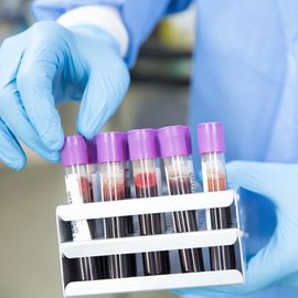 A scientist in gloves and an overall holds a rack of purple topped blood sample tubes and goes to pick one out. 
