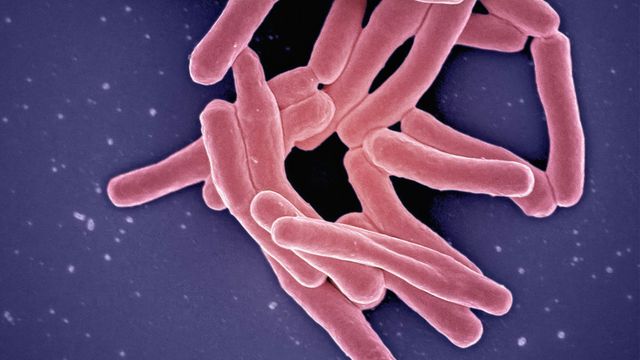 Patients With Drug-Resistant TB Benefit From Personalized Treatment Regimens