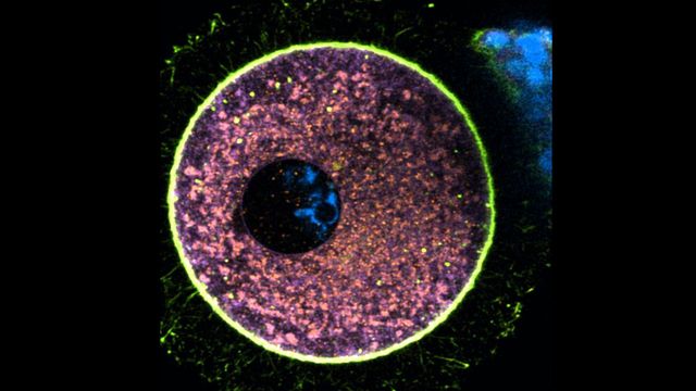 An immature human egg cell, fixed and immunolabeled with intracellular organelle markers.