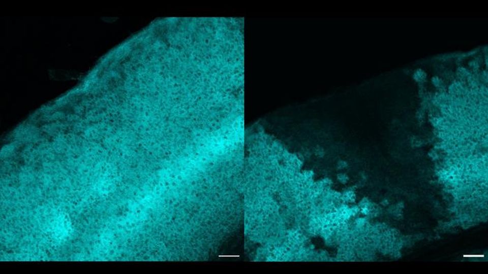 Images produced during the research show the effect of the team’s knockout of the protein Gat3.